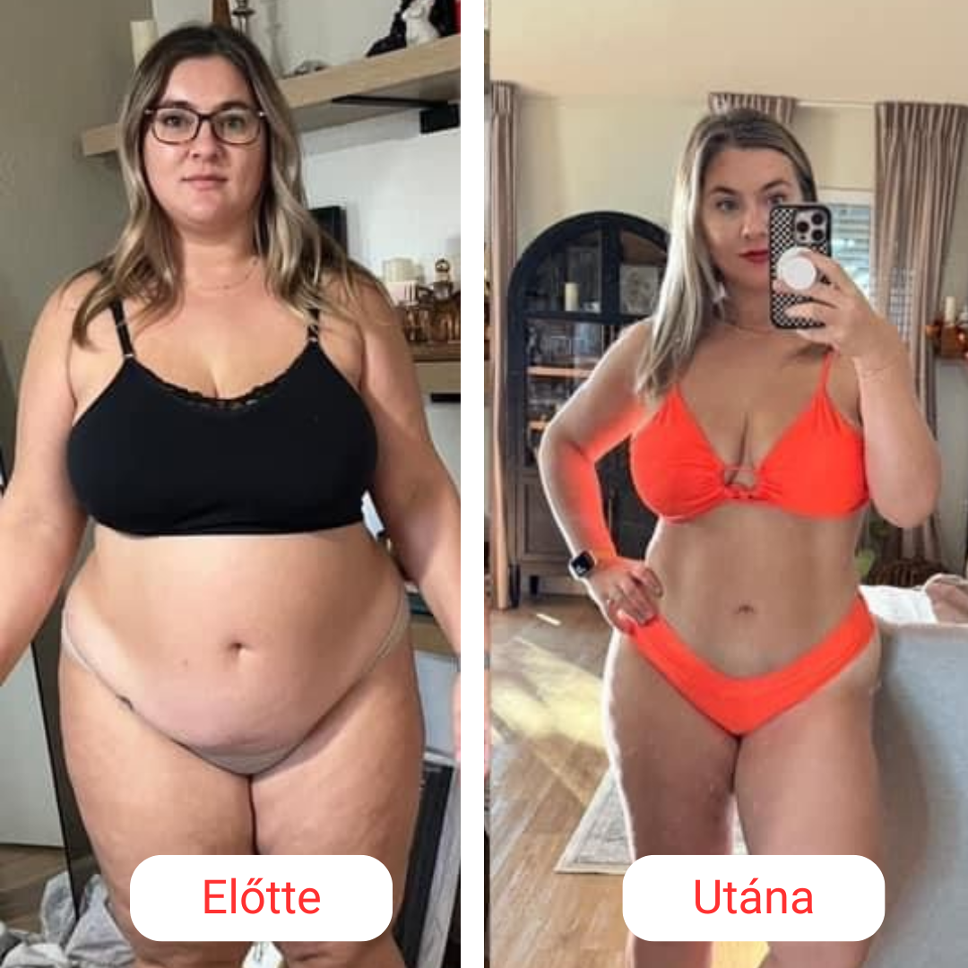 SkinShape Testformázó