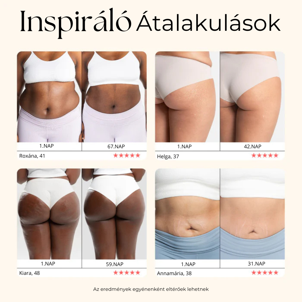 SkinShape Testformázó