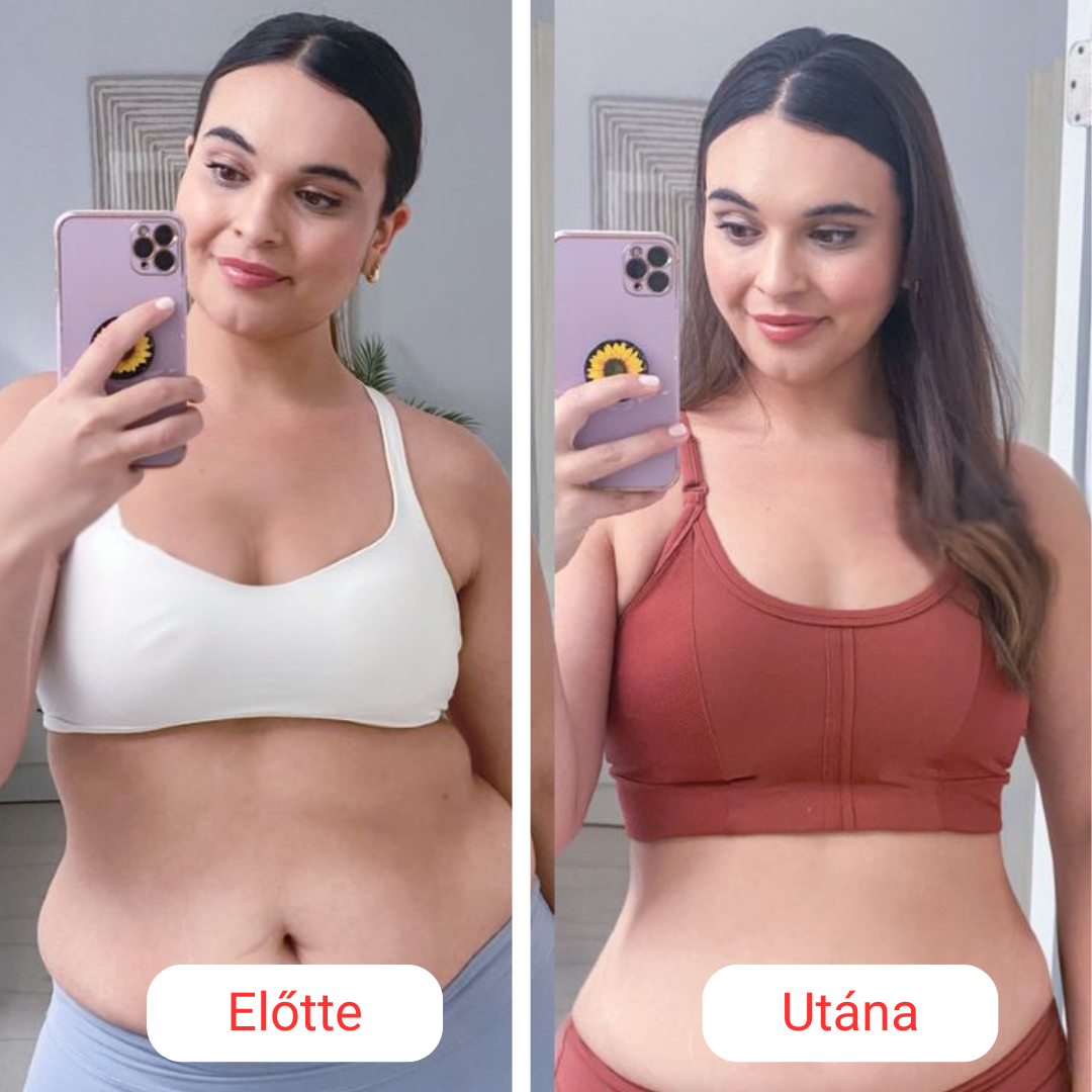 SkinShape Testformázó