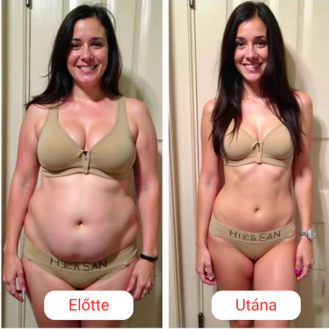 SkinShape Testformázó