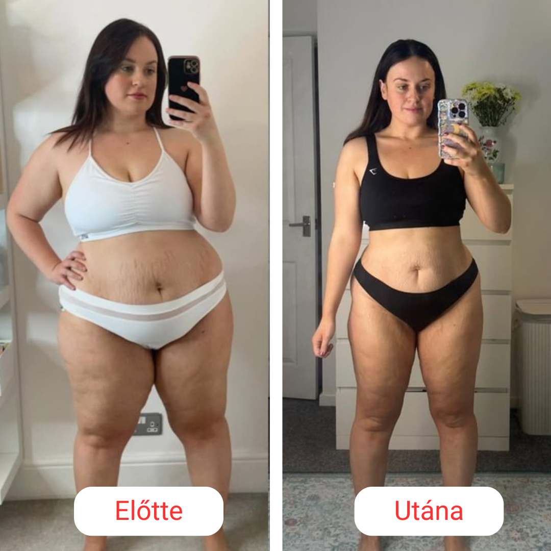 SkinShape Testformázó