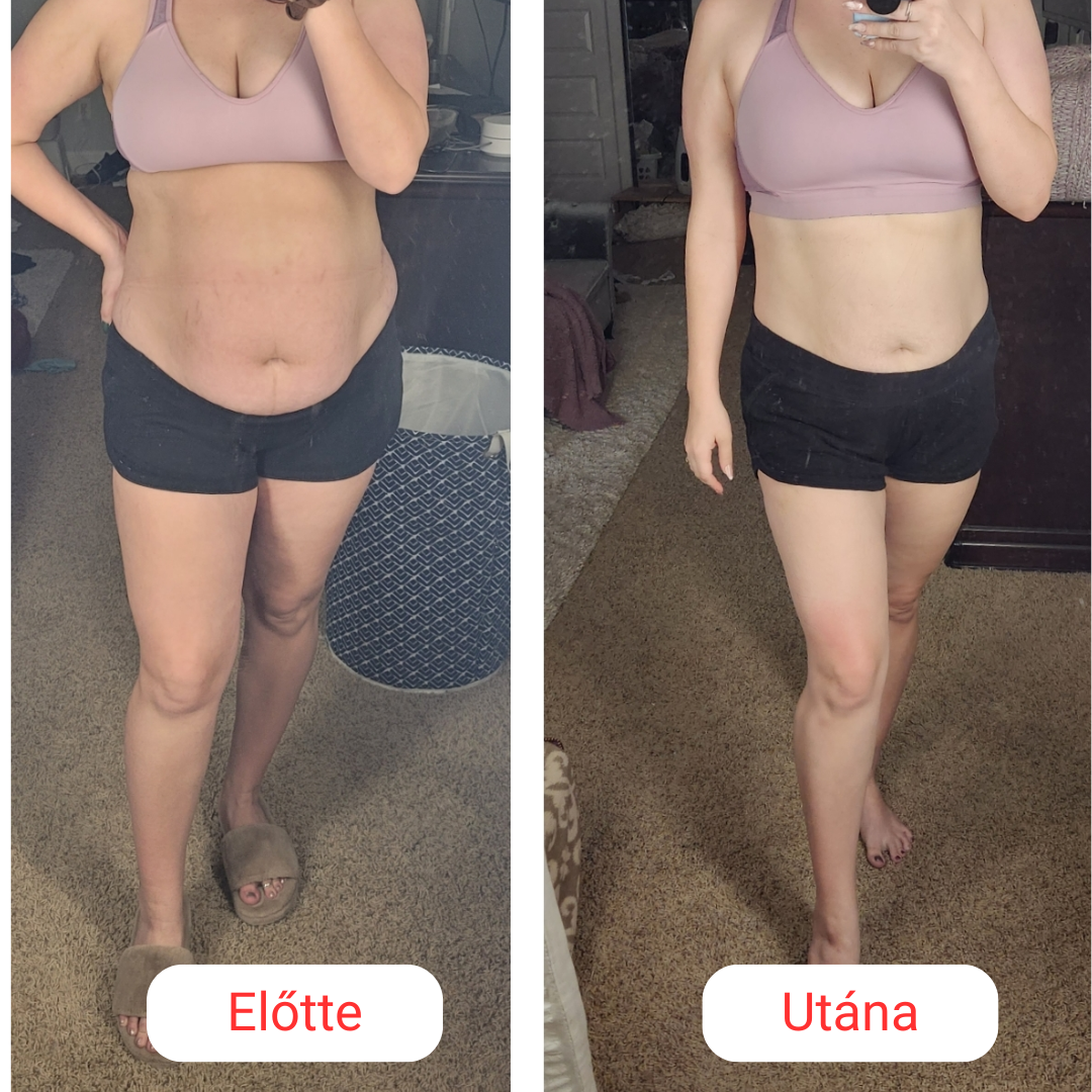 SkinShape Testformázó