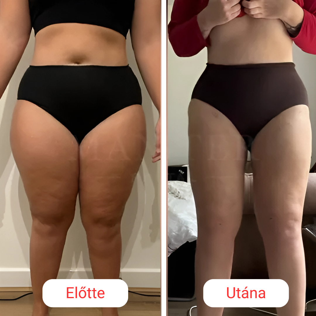 SkinShape Testformázó